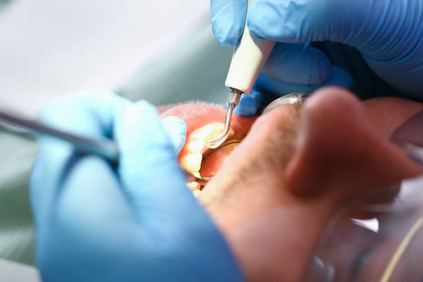 Best Emergency Denture Repair in West Milton, PA